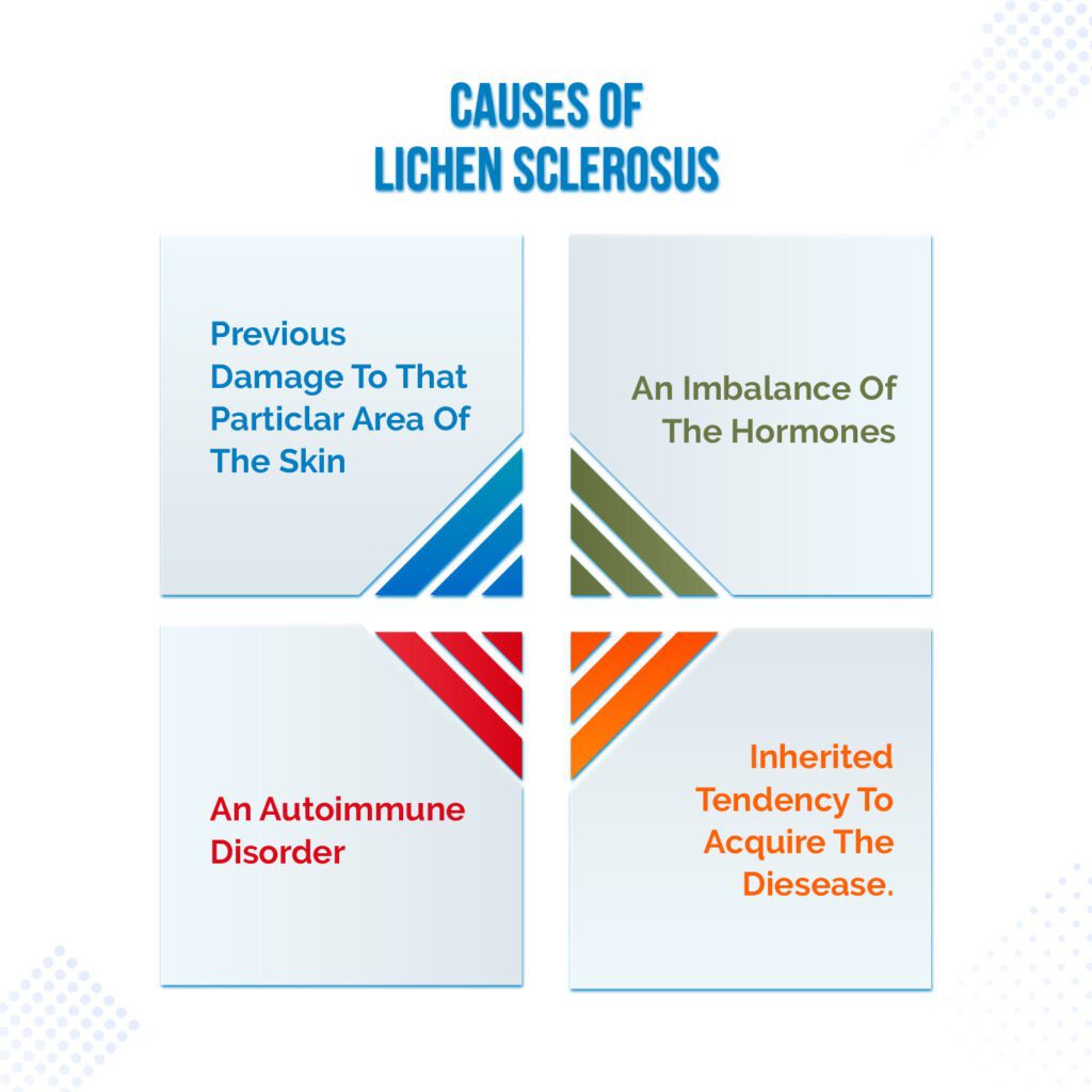 Causes of Lichen Sclerosus