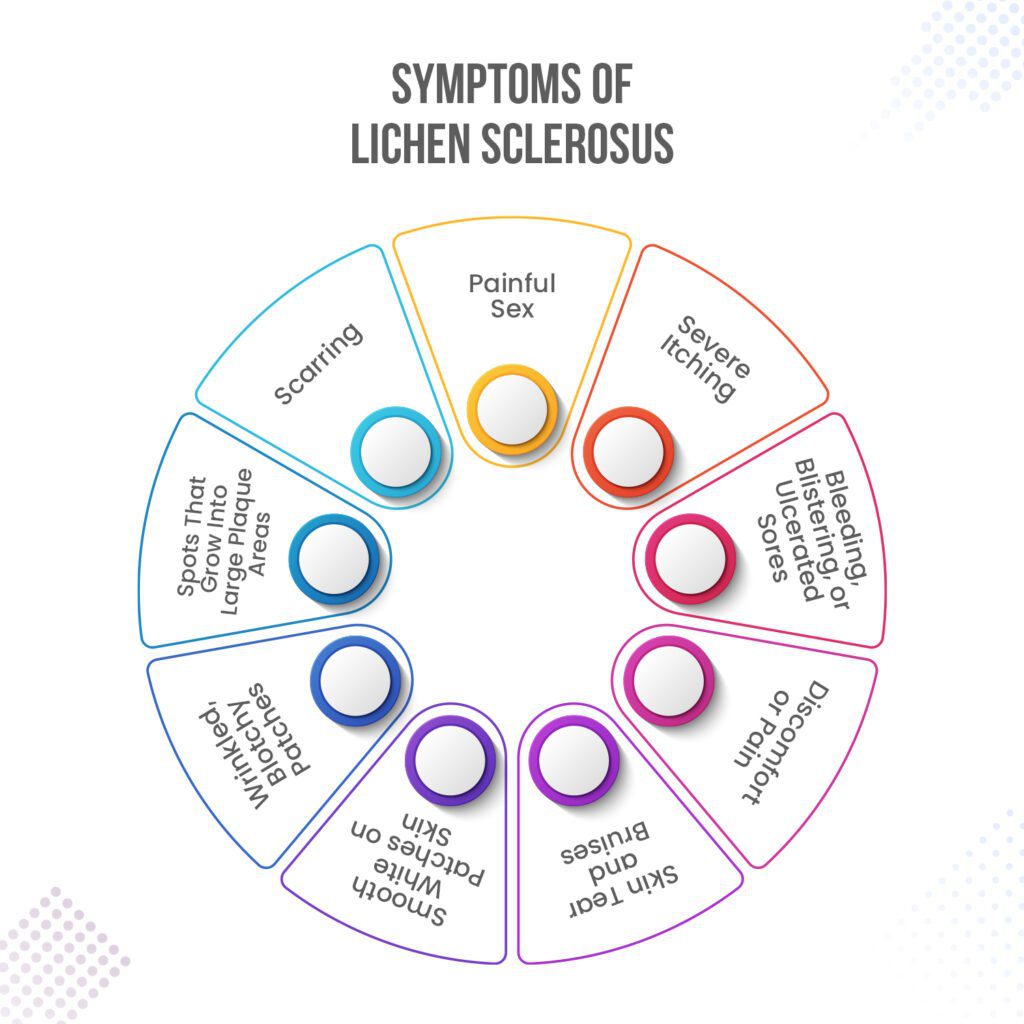 Symptoms of Lichen Sclerosus