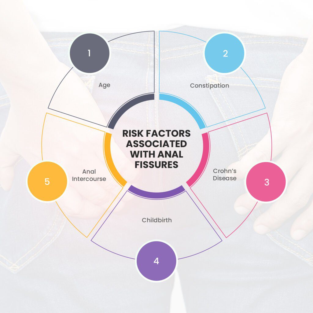 Risk Factors Associated With Anal Fissures