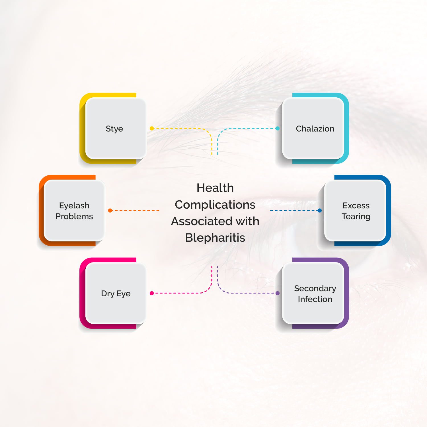 7 Simple Natural Remedies for Blepharitis The Hidden Cures