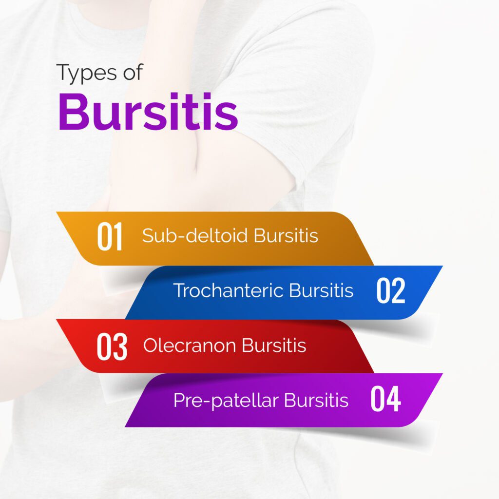 Types of Bursitis