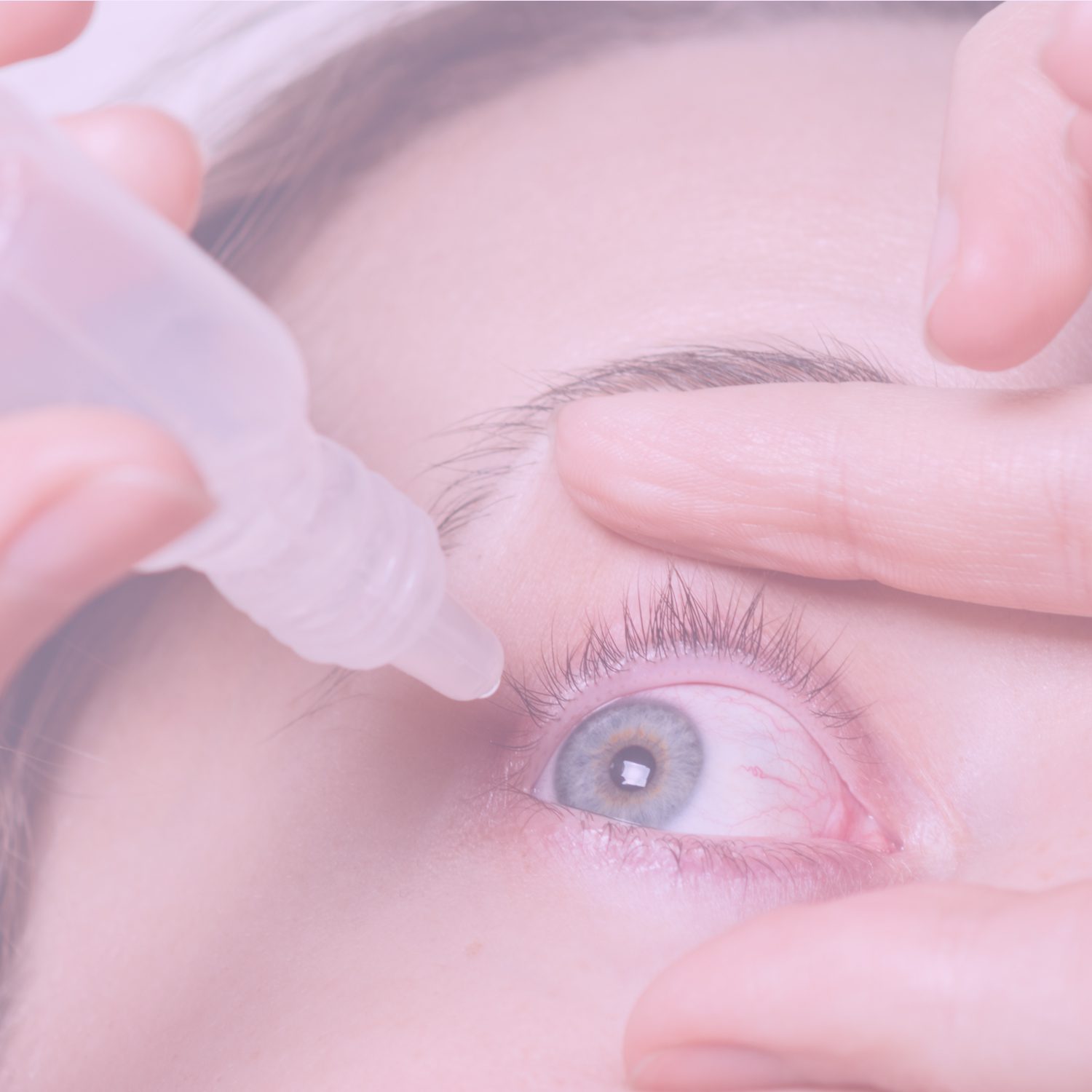  Eye Allergies: 10 Natural Remedies for Eye Allergy