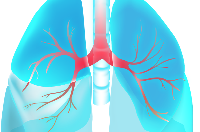  5 Effective Home Remedies To Get Rid Of Pulmonary Hypertension