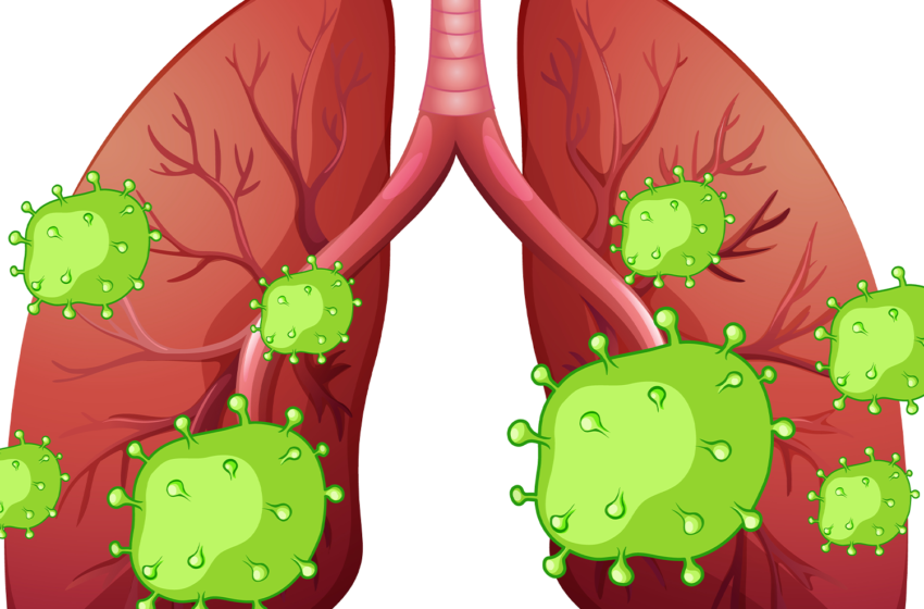  5 Powerful Home Remedies To Get Rid Of Lung Infection
