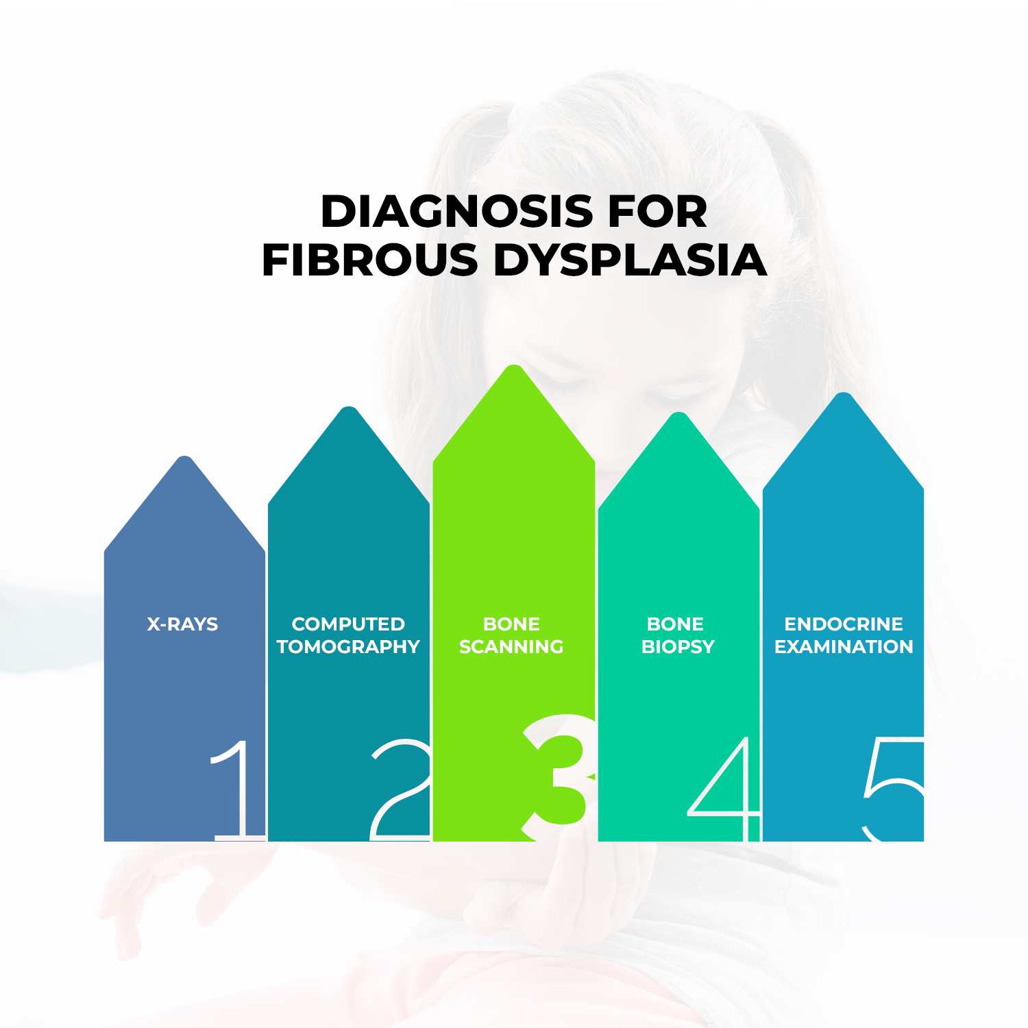 How Is Fibrous Dysplasia Diagnosed