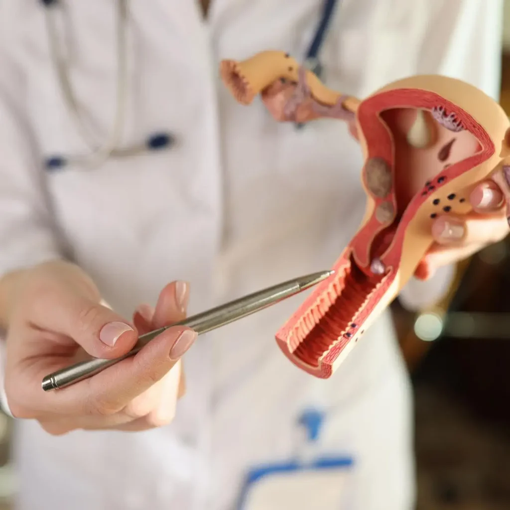 10 Effective Natural Remedies for Uterine Fibroids The Hidden Cures