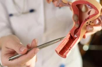 Uterine Fibroids