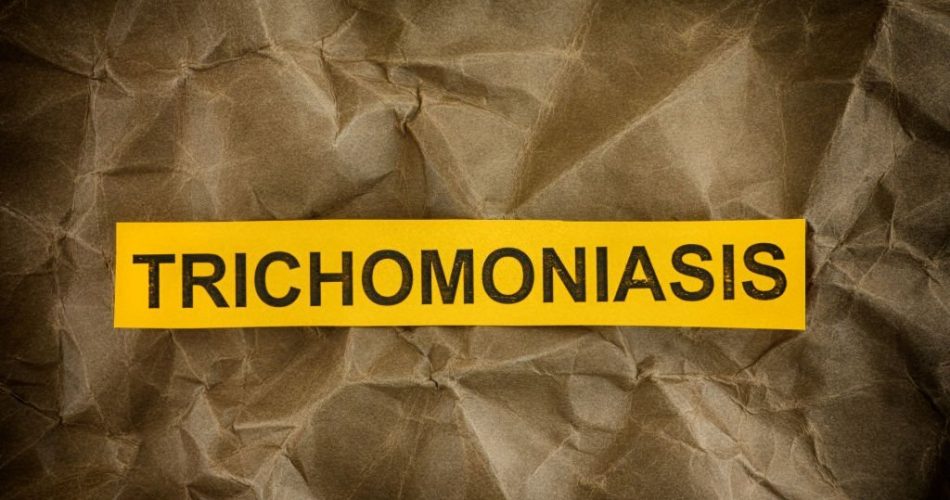 trichomoniasis.