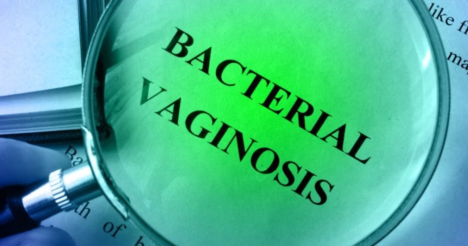 bacterial vaginosis.